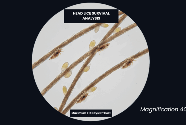 Microscopic view of head lice on human hair showing adult lice and nits for survival guide