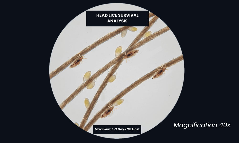 How Long Do Head Lice Live Off the Host? Complete Survival Guide for Parents